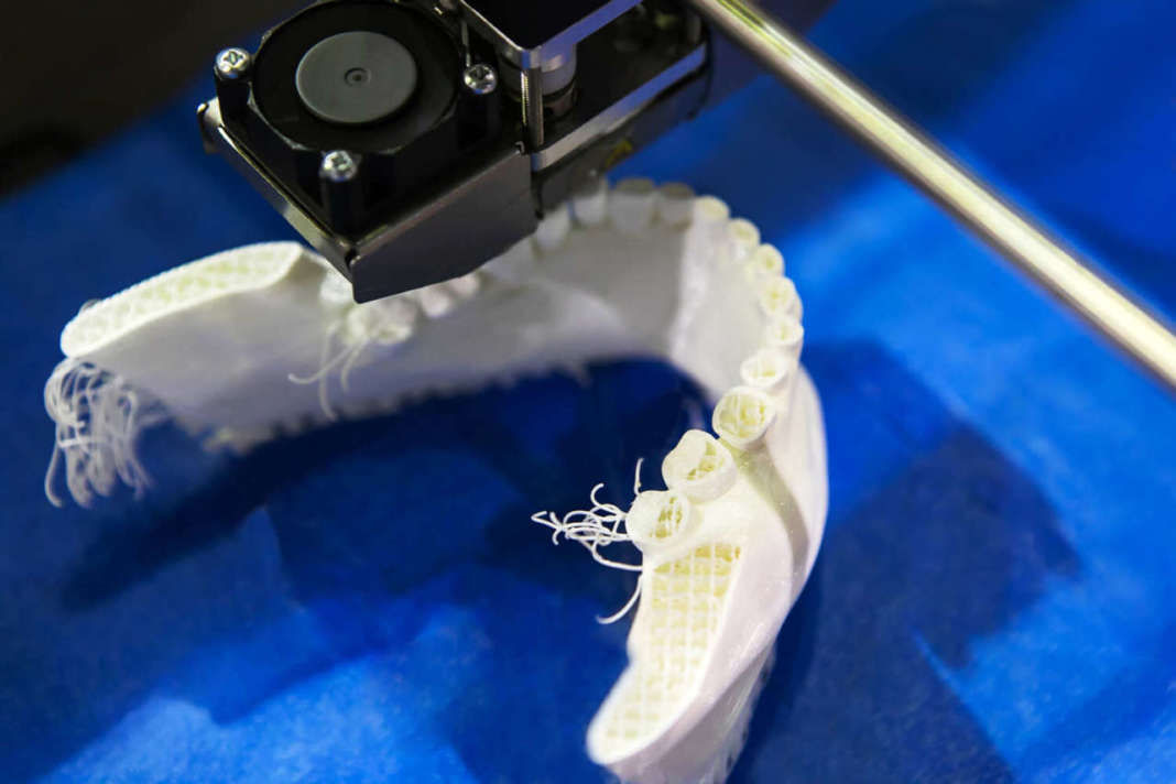 stampanti 3D odontoiatria